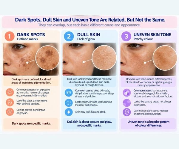 Uneven Skin Tone
